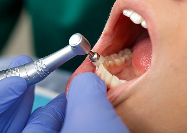 Best Wisdom Tooth Removal  in Ampere North, NJ